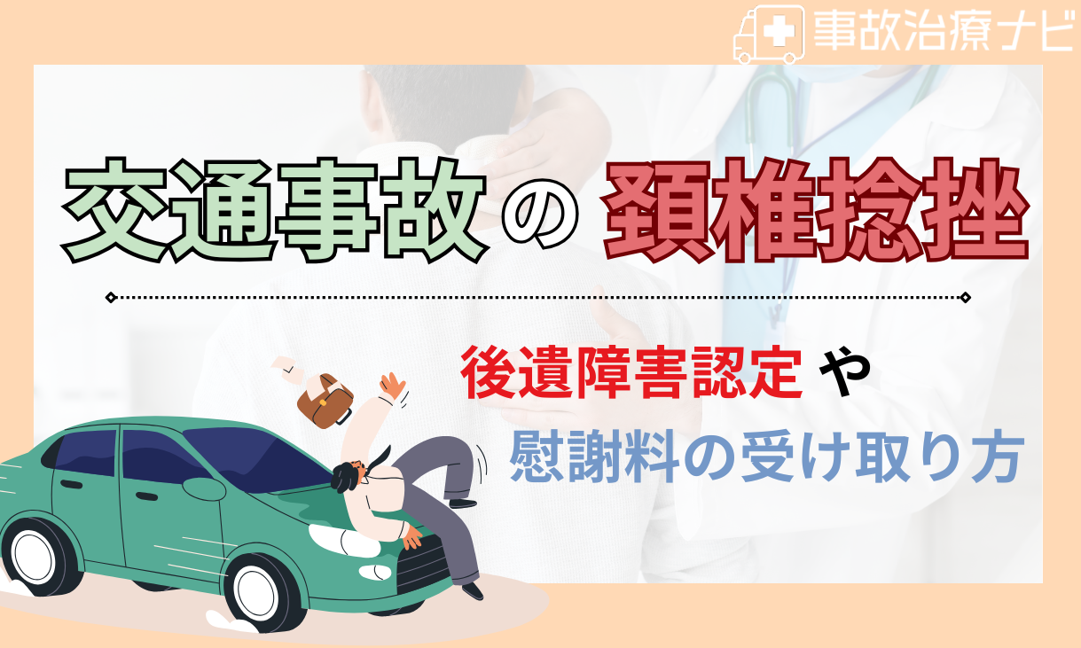 頸椎捻挫 後遺症